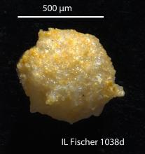 Microscopic view of spheroidal agglutinated foraminifera